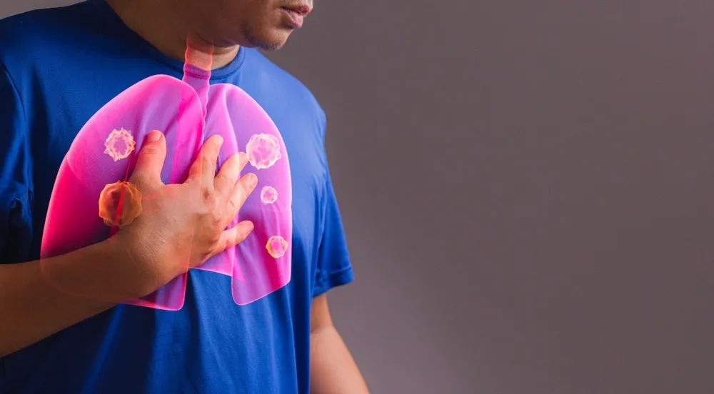 a man holding his chest with a diagram of a chest infection